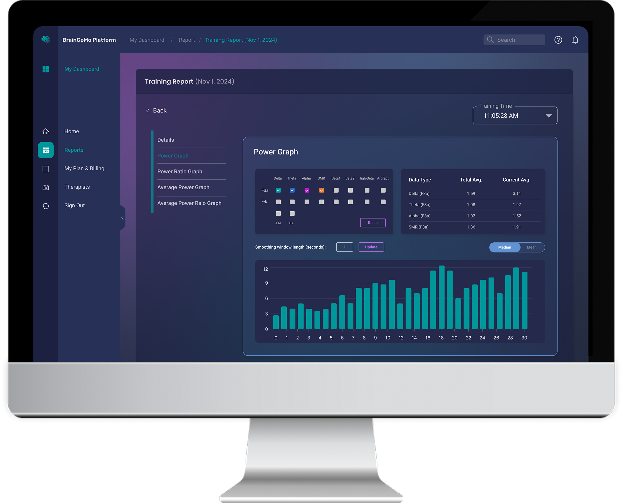 BrainGoMo Neurofeedback Dashboard